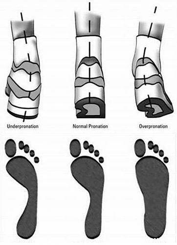 小腿肌肉外翻和膝盖内扣一样吗,小腿肌肉外翻骨头是弯的