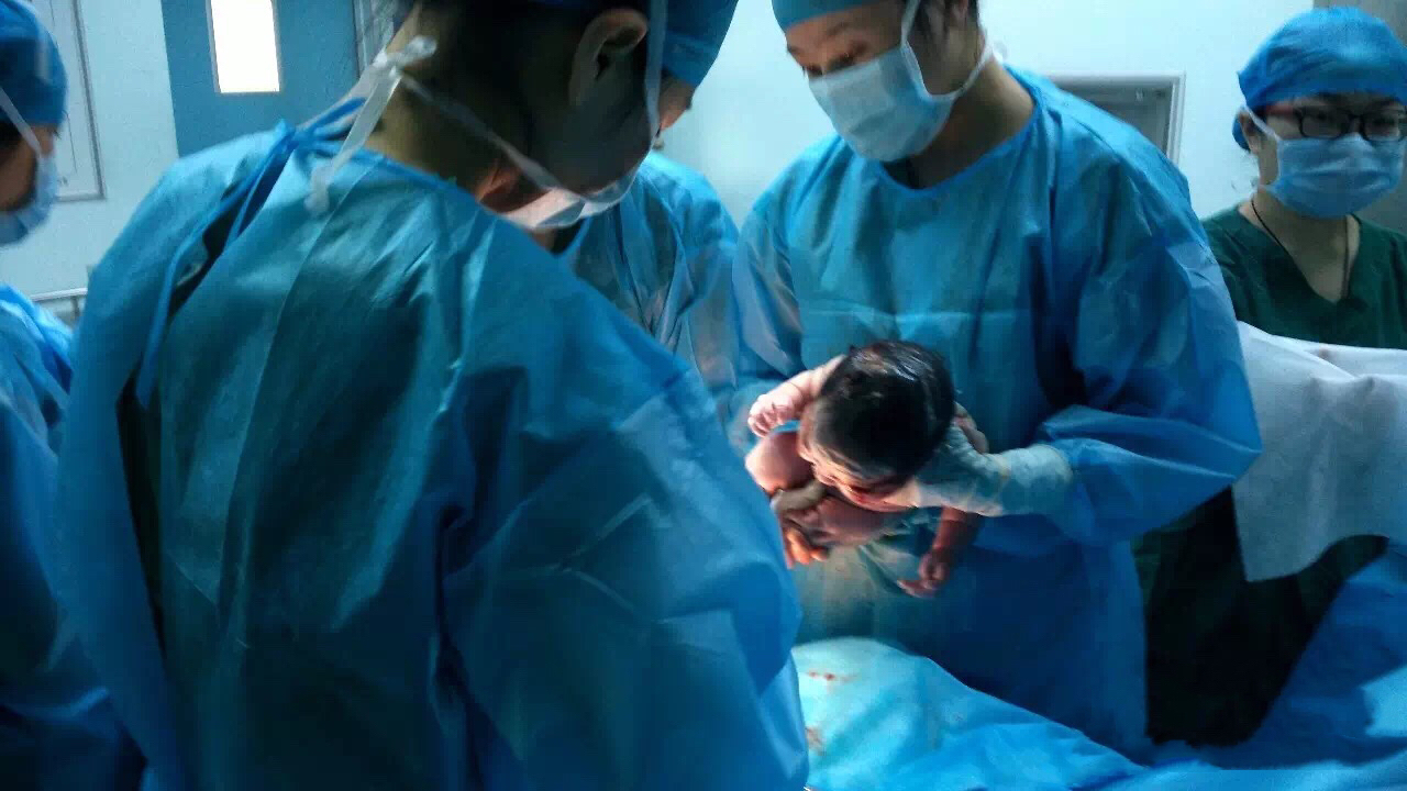 剖宫产真的比顺产好吗,剖宫产全过程解析