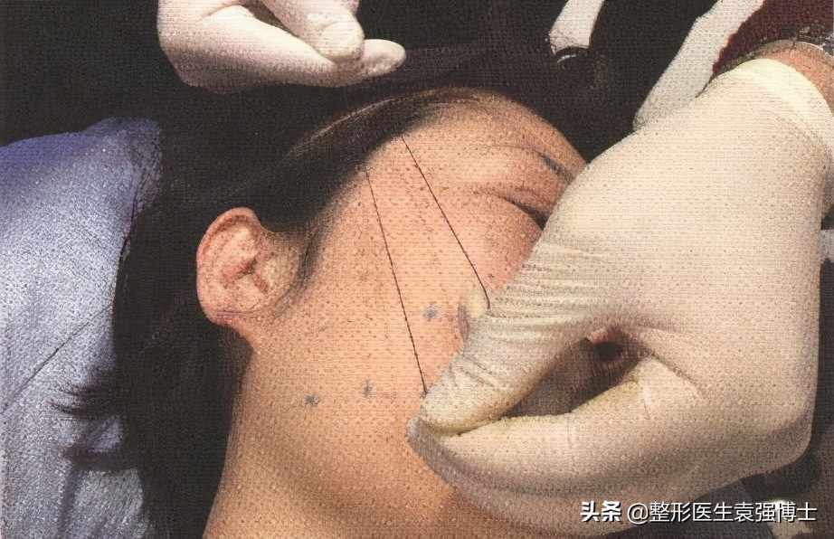 听医美专家讲座后的感想,听医生话对身体有什么危害