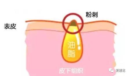 有这6个症状说明你的经络堵塞了,身体有5个征兆说明血管堵住了