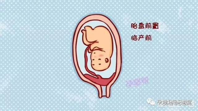 怀孕期间可以吃辣的火锅吗,怀孕期间能吃辣的和酸的吗