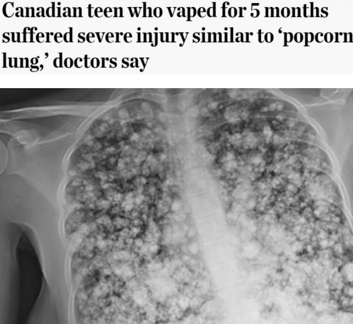 华人注意！加拿大今天将开始卖*麻大***子烟电**！嗨上加嗨，有致命危害