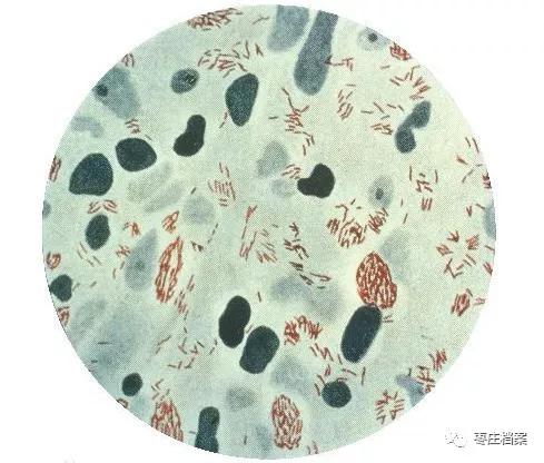 滕县麻风病医院石碑,滕县麻风病医院旧址