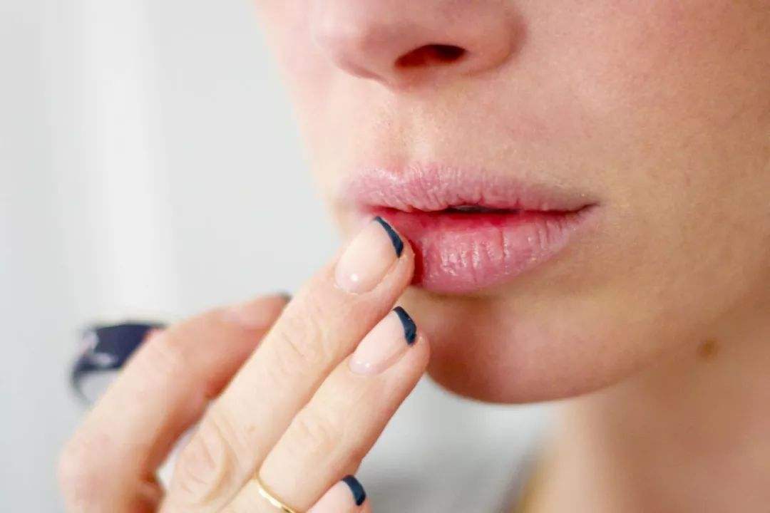 涂口红一直卡纹怎么办,涂口红总卡纹