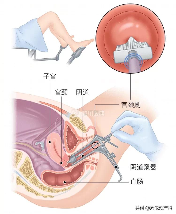 妇科医生避坑指南,妇科医生告诉你的10条建议