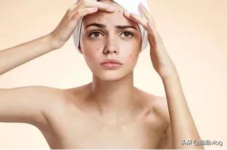 鼻子长痘痘怎么快速消除,鼻子长痘痘怎么办最快最有效