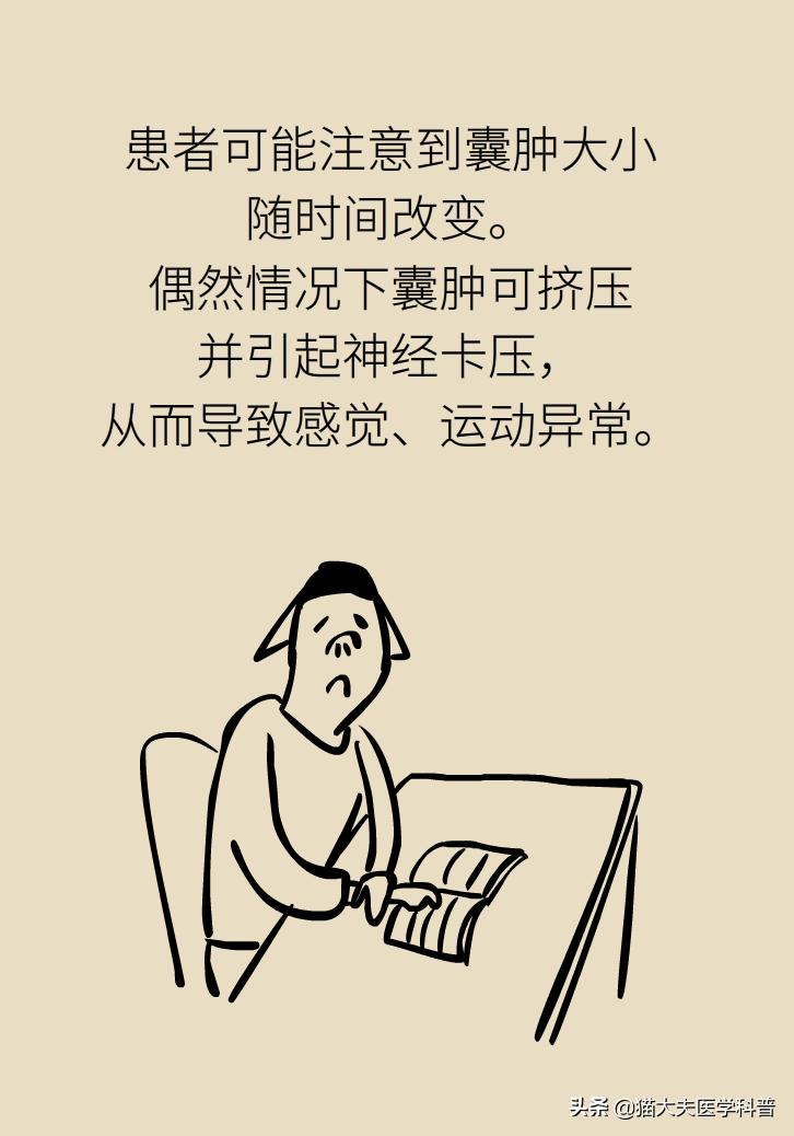 手腕长腱鞘囊肿,手腕上有个凸起的包腱鞘囊肿