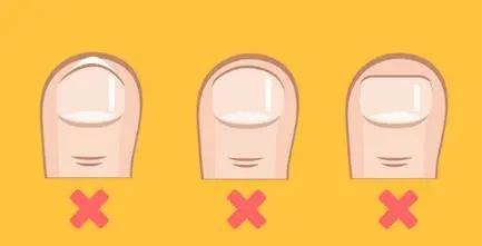 小知识一不小心扭伤脚了怎么处理,小脚趾指甲冷知识