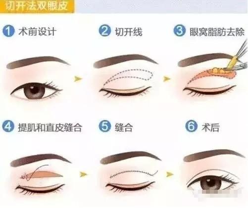 单眼皮的小姐姐,单眼皮怎么贴成欧式大双眼皮