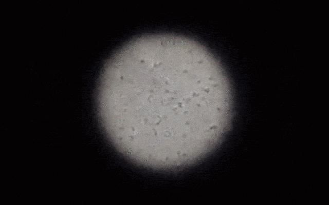 男性的精子怎么产生的,精子是旋转游动吗