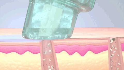 皮肤粗糙暗沉毛孔粗怎么改善,皮肤暗沉粗糙毛孔粗大