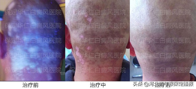 “他们待我如亲人”！患者辗转300余公里，连送保定华仁医院三面锦旗！