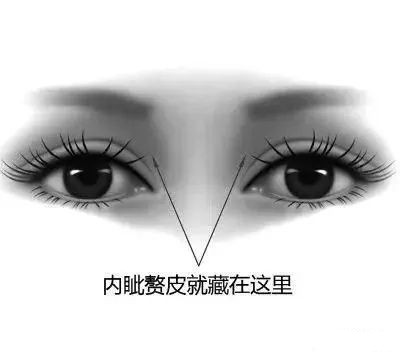 开眼角真的能变漂亮吗,关于开眼角你都了解什么