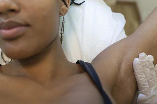 体毛浓密用什么脱毛最好,体毛脱毛的最佳方法