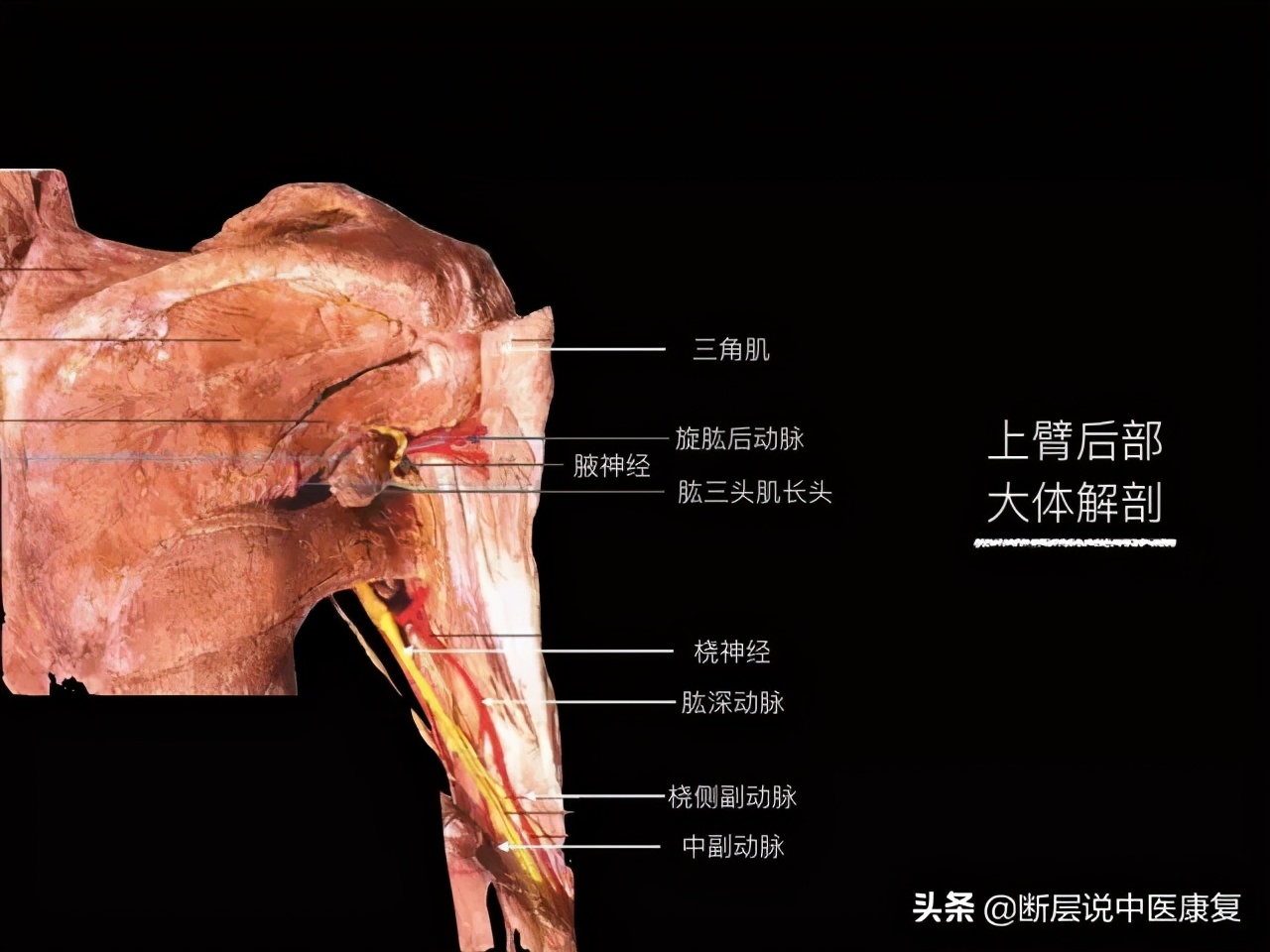 手臂人体解剖图讲解,手臂上举3d肌肉解剖讲解