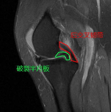 热爱跳舞的阿姨们,热爱广场舞的阿姨