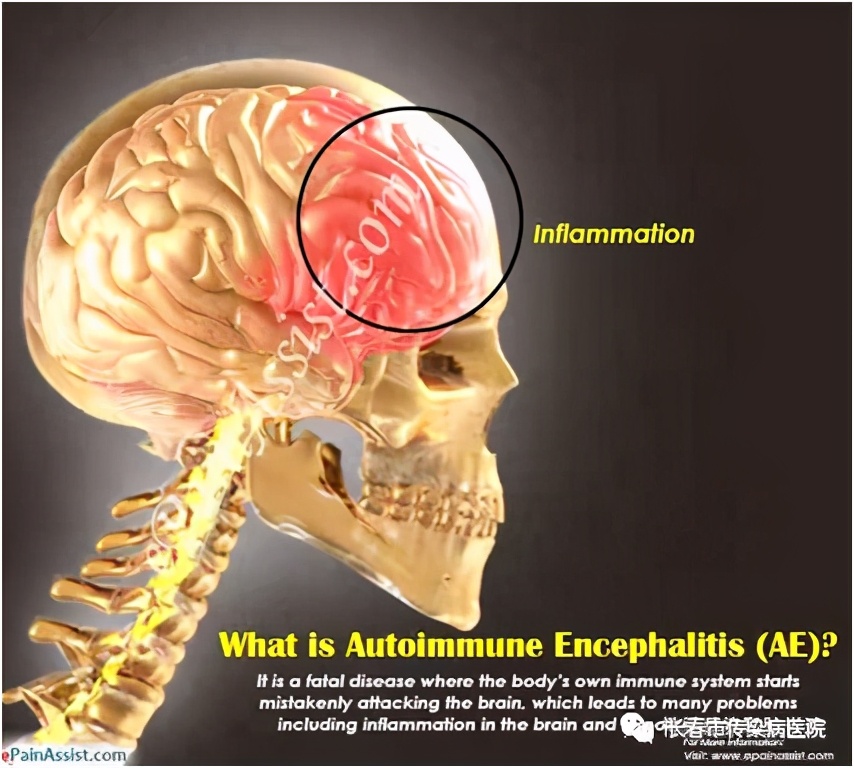 救命的3小时，惠民利民的“脑（膜）炎一站式快速诊断平台”望在全省逐步开展