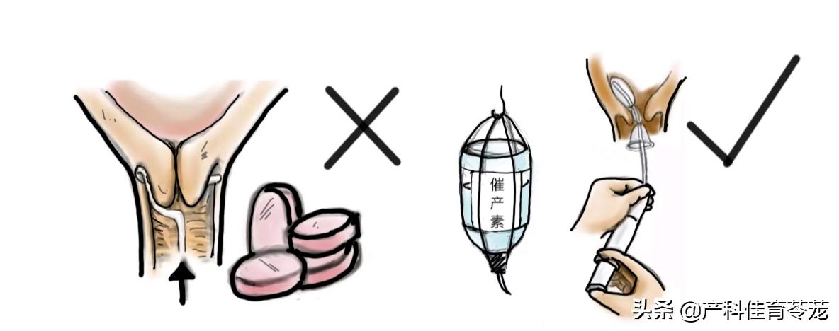 上次剖腹产一年半能再次怀孕吗,上次剖宫产这次能顺产不