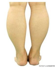 消灭小腿粗壮三大动作,如何消灭小腿肌