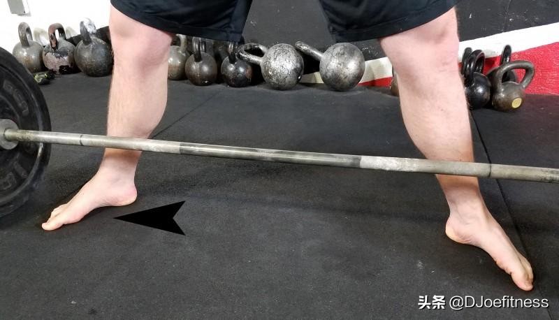 腰部损伤能好吗,腰受伤了以后还能做硬拉吗