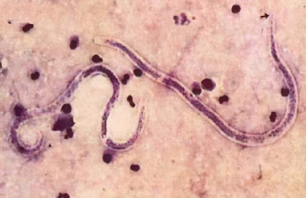 布偶猫着凉拉稀怎么办,布偶猫受凉引起的拉肚子怎么治