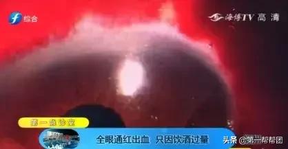 福州男子喝酒胃里全是血,福州一男子倒地吐血