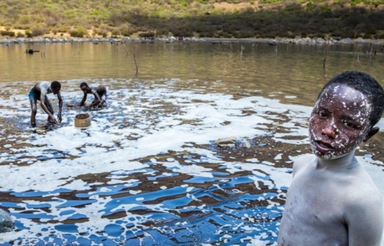 非洲高危职业:一天2次,每天60元,3年时间足够使人又聋又瞎