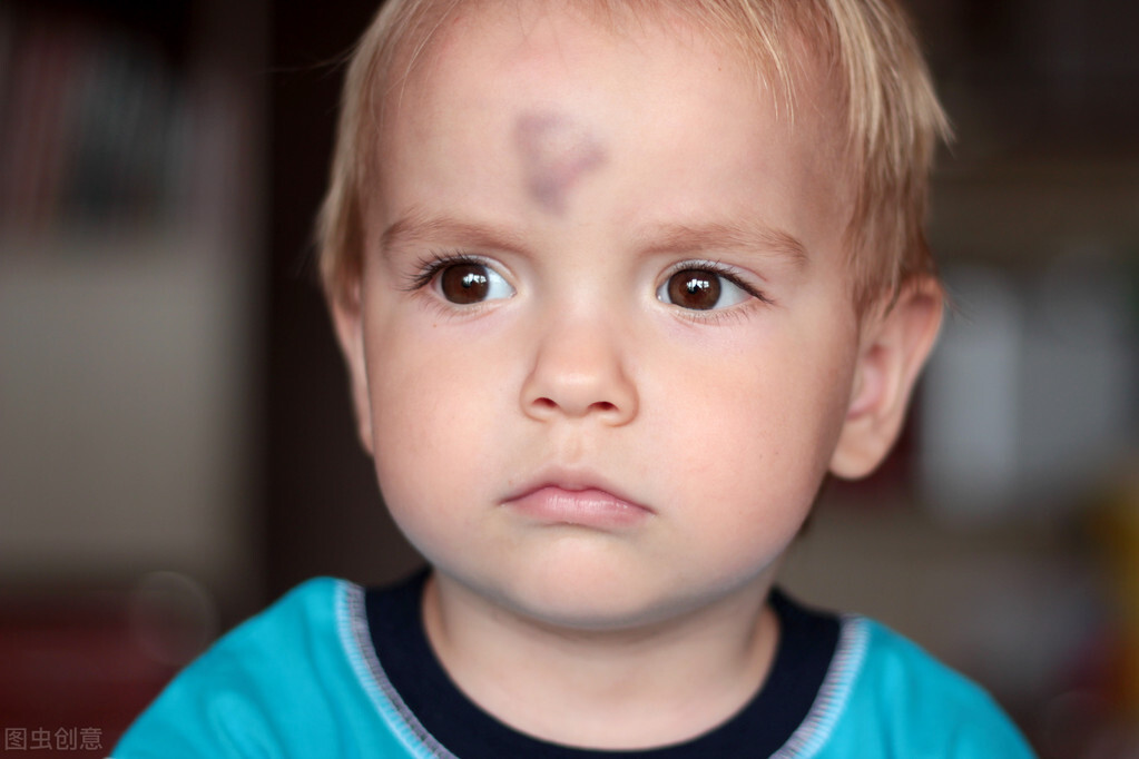 1岁宝宝摔跤头上起大包怎么办,小孩子摔跤很容易起包是怎么回事