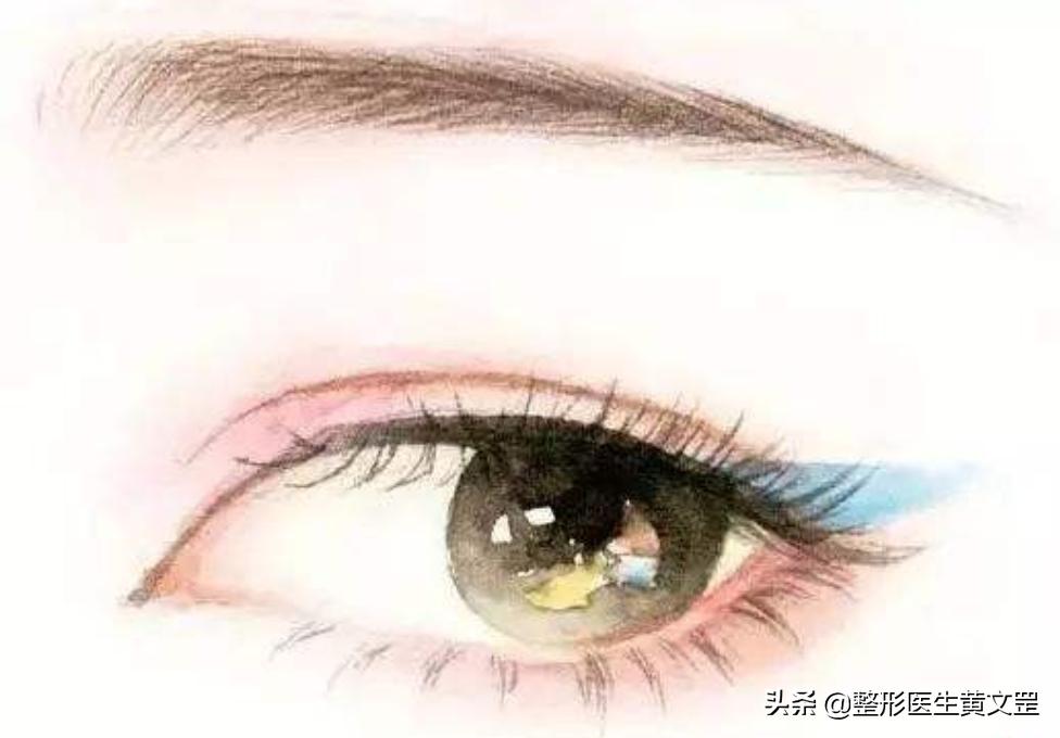 割完双眼皮后的注意事项图文,割完双眼皮后注意事项和禁忌