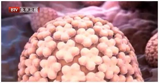 身上长了很多小疣是hpv感染了吗,身上有肿块是否是hpv造成