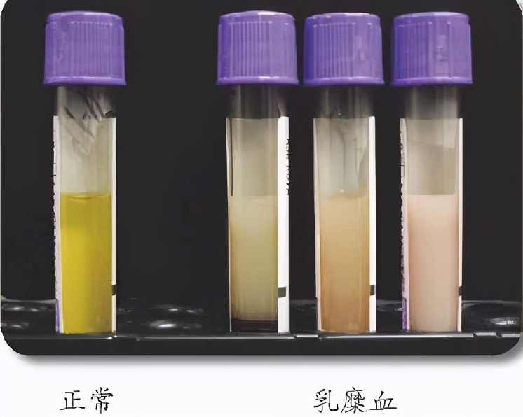 50岁的阿姨早上要吃什么,50岁阿姨饮食