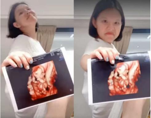 谢依霖二胎自己动手剪脐带,谢依霖顺产分享