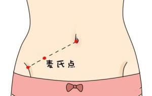 漫谈疾病过程中的“压痛点”现象