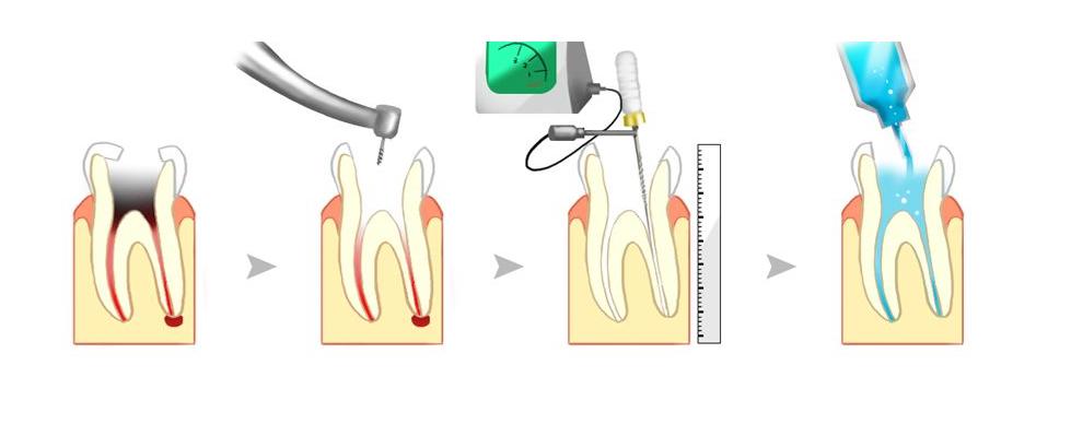 口腔矫正的十大误区,口腔误区