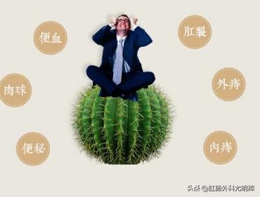 pph痔疮手术报销比例有多少,痔疮微创手术pph价格