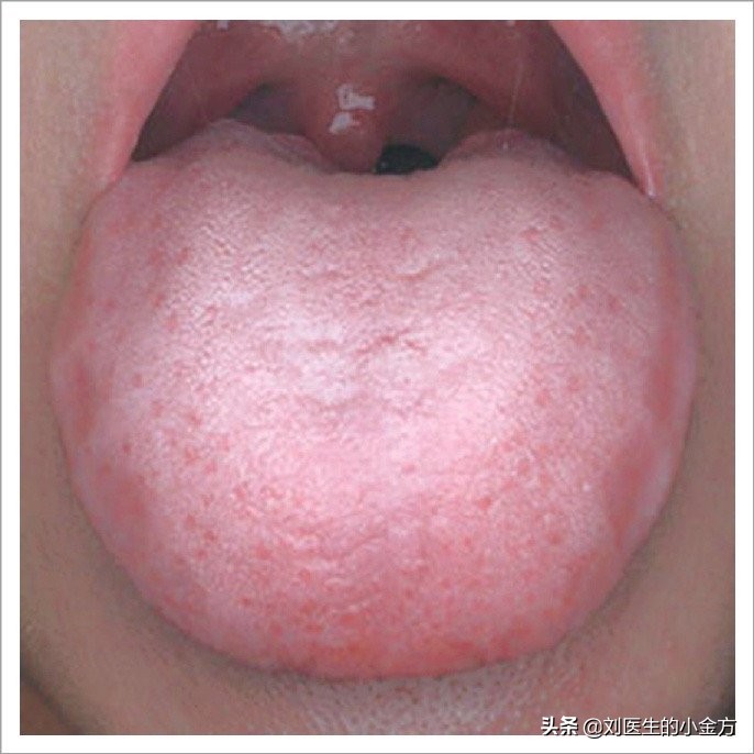 中医舌诊对照表100例,舌诊辨九大体质