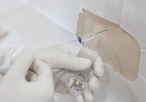 脑脊液检查结果都没事,脑脊液每次结果都不一样