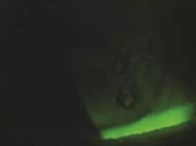 干眼症为什么要查过敏原,怎么判断是过敏还是干眼