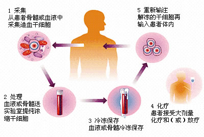 关于贫血诊断,贫血知识普及