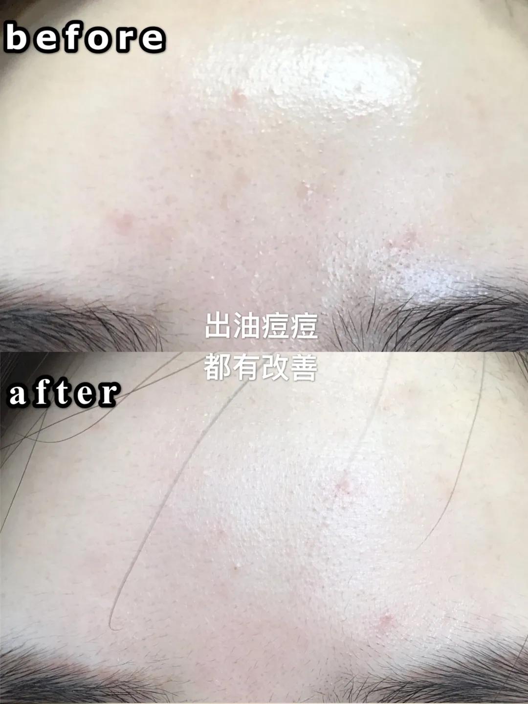 红腰子精华测评三代,第三代红腰子精华测评