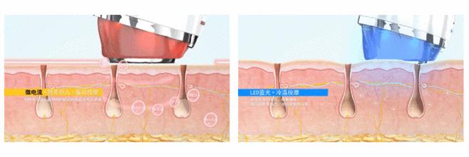 做美容的女人勇气可嘉,打了美容针的女人现在怎么样了