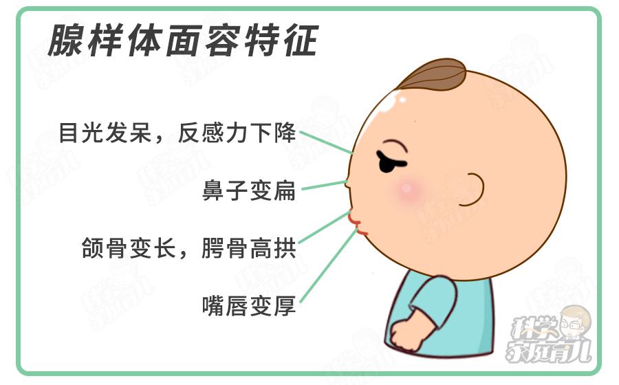 孩子腺样体肥大不手术的好方法,腺样体肥大是做手术还是保守治疗