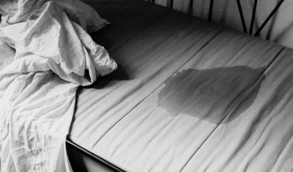 儿童尿床和遗尿症有什么区别,经常尿床是儿童遗尿症吗