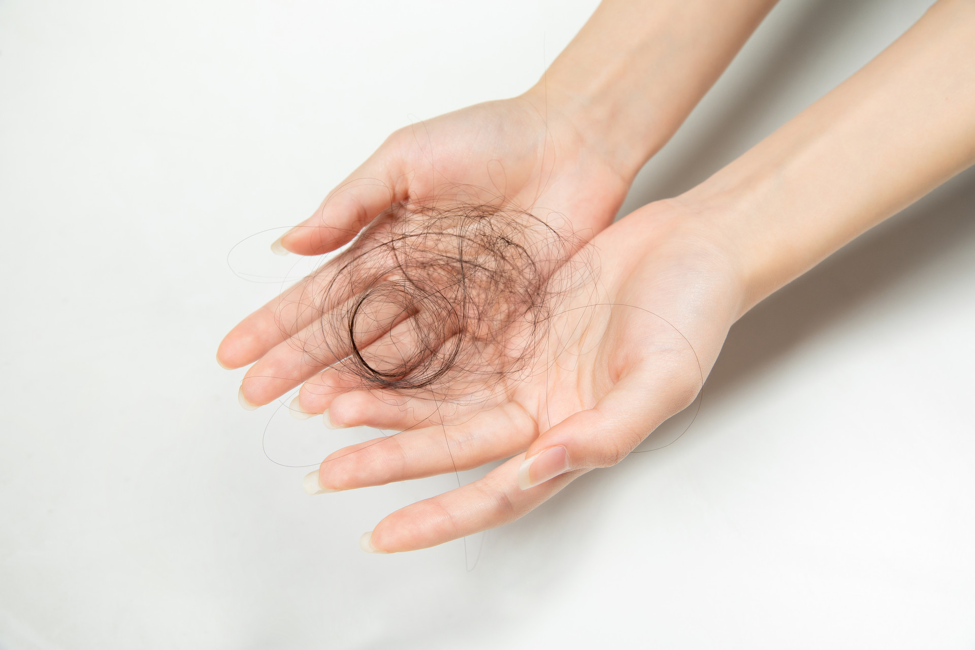 头屑多头发又掉是缺什么,头皮掉大块头屑是要秃头了吗