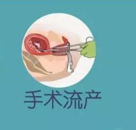 你知道人流方面的常识吗,人流要用平常心对待