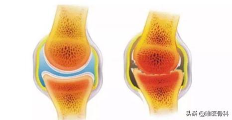 跑步机跟路上跑哪个效果更好,跑步机和户外跑哪个更有效