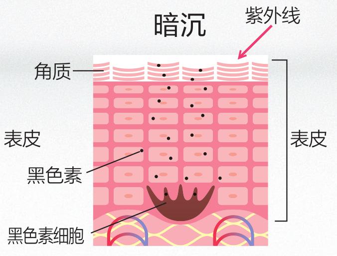 秦海璐晒到脱皮，陈伟霆晒成炭黑色，三角涂抹抗UV护理