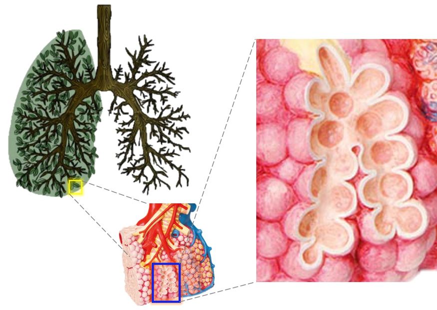 感染病毒,死于窒息:肺里究竟发生了什么?