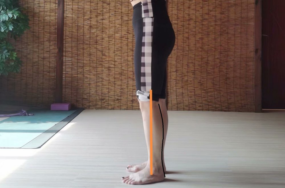 小腿外翻膝超伸如何改善,单侧膝超伸导致腿短一点