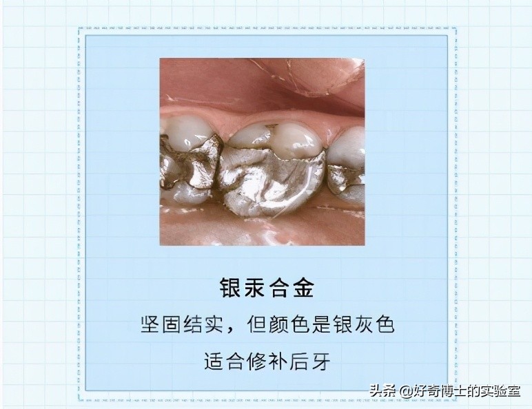 治牙到底有多恐怖,治牙有多痛苦